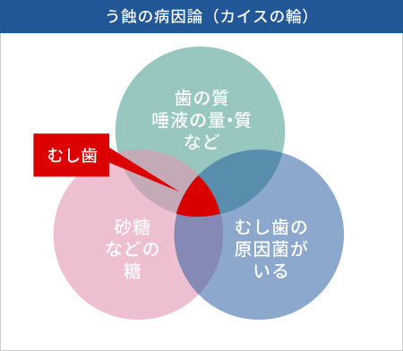 う蝕の病因論（カイスの輪）